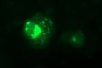 MMP13 Antibody in Immunocytochemistry (ICC/IF)