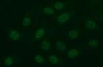 MMP13 Antibody in Immunocytochemistry (ICC/IF)