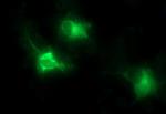 MMP13 Antibody in Immunocytochemistry (ICC/IF)