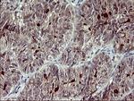 MMP13 Antibody in Immunohistochemistry (Paraffin) (IHC (P))