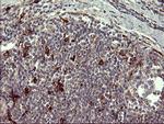 MMP13 Antibody in Immunohistochemistry (Paraffin) (IHC (P))