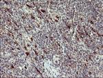 MMP13 Antibody in Immunohistochemistry (Paraffin) (IHC (P))