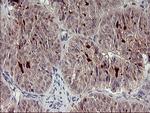 MMP13 Antibody in Immunohistochemistry (Paraffin) (IHC (P))