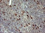 MMP13 Antibody in Immunohistochemistry (Paraffin) (IHC (P))