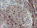 MMP13 Antibody in Immunohistochemistry (Paraffin) (IHC (P))