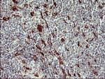 MMP13 Antibody in Immunohistochemistry (Paraffin) (IHC (P))