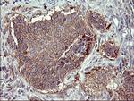 MMP13 Antibody in Immunohistochemistry (Paraffin) (IHC (P))