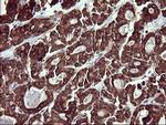 MMP13 Antibody in Immunohistochemistry (Paraffin) (IHC (P))