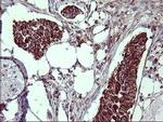 MMP13 Antibody in Immunohistochemistry (Paraffin) (IHC (P))