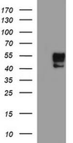 MMP13 Antibody in Western Blot (WB)