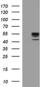 MMP13 Antibody in Western Blot (WB)