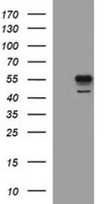 MMP13 Antibody in Western Blot (WB)