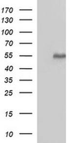 MMP13 Antibody in Western Blot (WB)