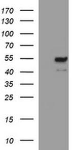 MMP13 Antibody in Western Blot (WB)