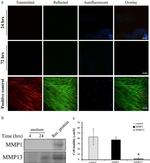 MMP13 Antibody in Western Blot (WB)