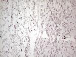 MMP2 Antibody in Immunohistochemistry (Paraffin) (IHC (P))