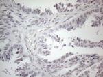 MMP2 Antibody in Immunohistochemistry (Paraffin) (IHC (P))