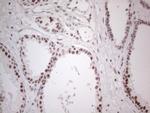 MMP2 Antibody in Immunohistochemistry (Paraffin) (IHC (P))