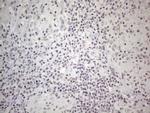 MMP2 Antibody in Immunohistochemistry (Paraffin) (IHC (P))