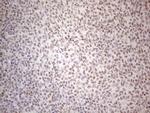 MMP2 Antibody in Immunohistochemistry (Paraffin) (IHC (P))