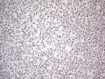 MMP2 Antibody in Immunohistochemistry (Paraffin) (IHC (P))