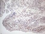 MMP2 Antibody in Immunohistochemistry (Paraffin) (IHC (P))