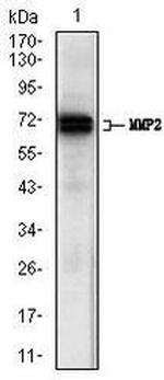 MMP2 Antibody in Western Blot (WB)