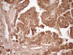 MMP3 Antibody in Immunohistochemistry (Paraffin) (IHC (P))