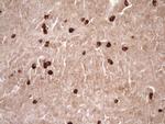 MMP3 Antibody in Immunohistochemistry (Paraffin) (IHC (P))