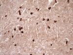 MMP3 Antibody in Immunohistochemistry (Paraffin) (IHC (P))