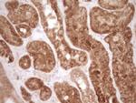 MMP3 Antibody in Immunohistochemistry (Paraffin) (IHC (P))