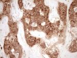 MMP3 Antibody in Immunohistochemistry (Paraffin) (IHC (P))