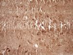 MMP3 Antibody in Immunohistochemistry (Paraffin) (IHC (P))