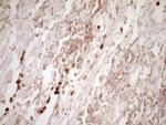 MMP3 Antibody in Immunohistochemistry (Paraffin) (IHC (P))