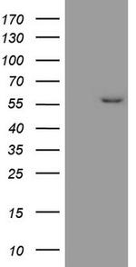 MMP3 Antibody in Western Blot (WB)