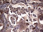 MMP7 Antibody in Immunohistochemistry (Paraffin) (IHC (P))