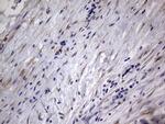 MMP7 Antibody in Immunohistochemistry (Paraffin) (IHC (P))