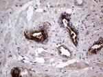 MMP7 Antibody in Immunohistochemistry (Paraffin) (IHC (P))