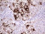 MMP7 Antibody in Immunohistochemistry (Paraffin) (IHC (P))