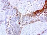 MMP7 Antibody in Immunohistochemistry (Paraffin) (IHC (P))