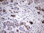 MMP7 Antibody in Immunohistochemistry (Paraffin) (IHC (P))