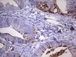 MMP7 Antibody in Immunohistochemistry (Paraffin) (IHC (P))