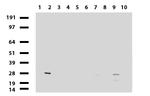 MMP7 Antibody in Western Blot (WB)