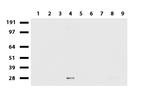 MMP7 Antibody in Western Blot (WB)