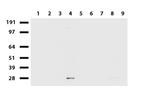 MMP7 Antibody in Western Blot (WB)