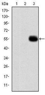 MMP9 Antibody in Western Blot (WB)