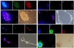 Cytokeratin Pan Type I/II Antibody in Immunocytochemistry (ICC/IF)