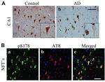 Phospho-Tau (Ser202, Thr205) Antibody in Immunohistochemistry (IHC)