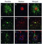 Phospho-Tau (Ser202, Thr205) Antibody in Immunohistochemistry (IHC)