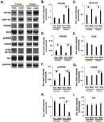 Phospho-Tau (Ser202, Thr205) Antibody in Western Blot (WB)